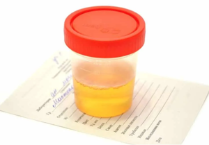 Аналізи при прохожденні медоглядів